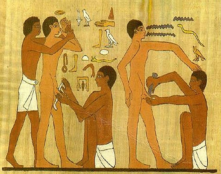 Fil:Egyptisk omskärelse.jpg